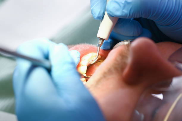 Best Emergency Dental Care for Broken or Chipped Teeth in Delavan Lake, WI