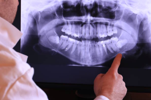 Best Cosmetic Emergency Dentistry in Delavan Lake, WI