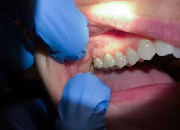 Best Emergency TMJ Treatment in Delavan Lake, WI