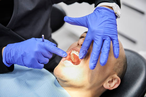 Best Emergency Dental Care for Broken or Chipped Teeth in Delavan Lake, WI