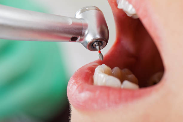 Best Emergency Treatment for Dental Infections or Abscesses in Delavan Lake, WI